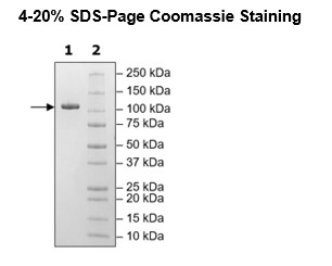 4-20% SDS-PAGE Coomassie Staining